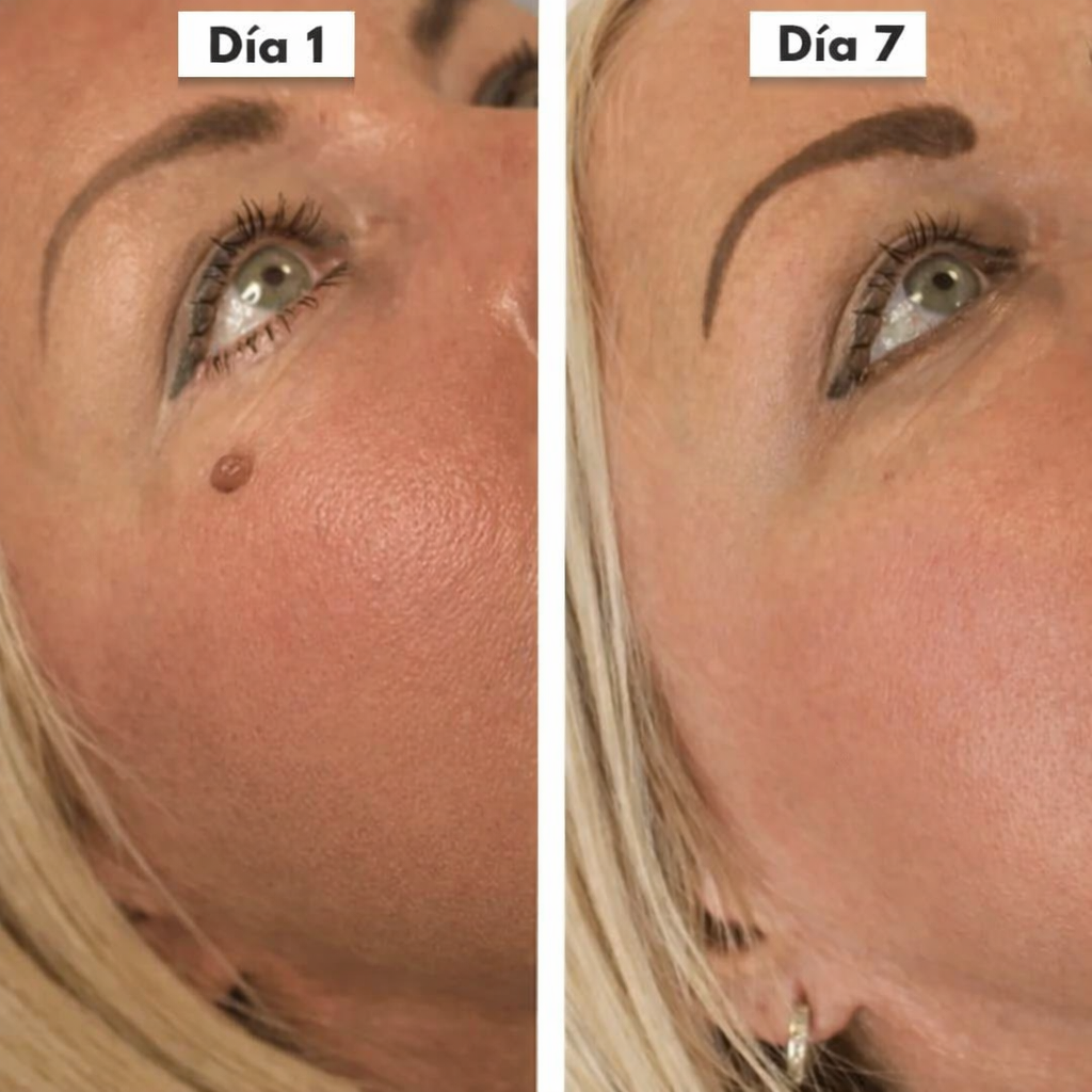 DermaSkin Pro