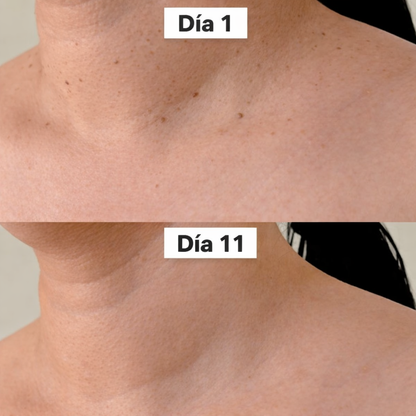 DermaSkin Pro