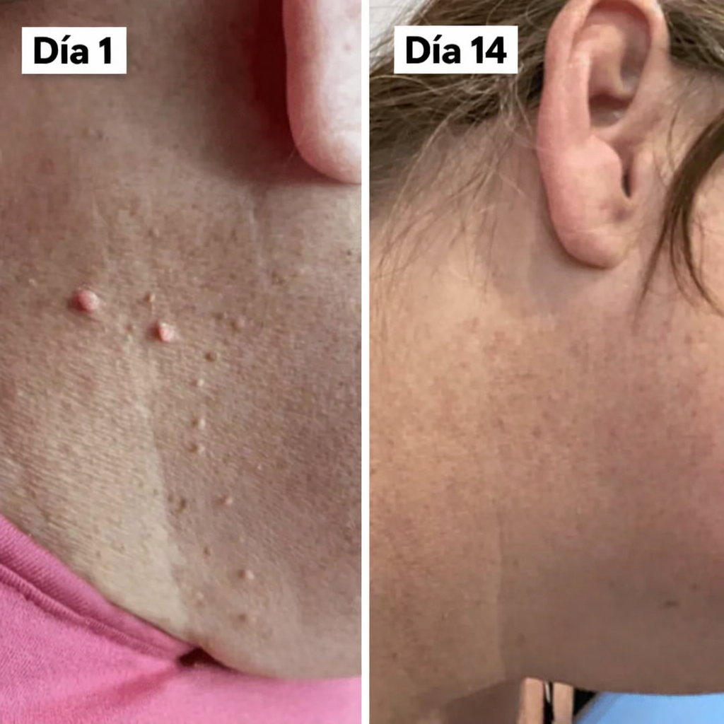 DermaSkin Pro