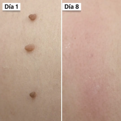 DermaSkin Pro